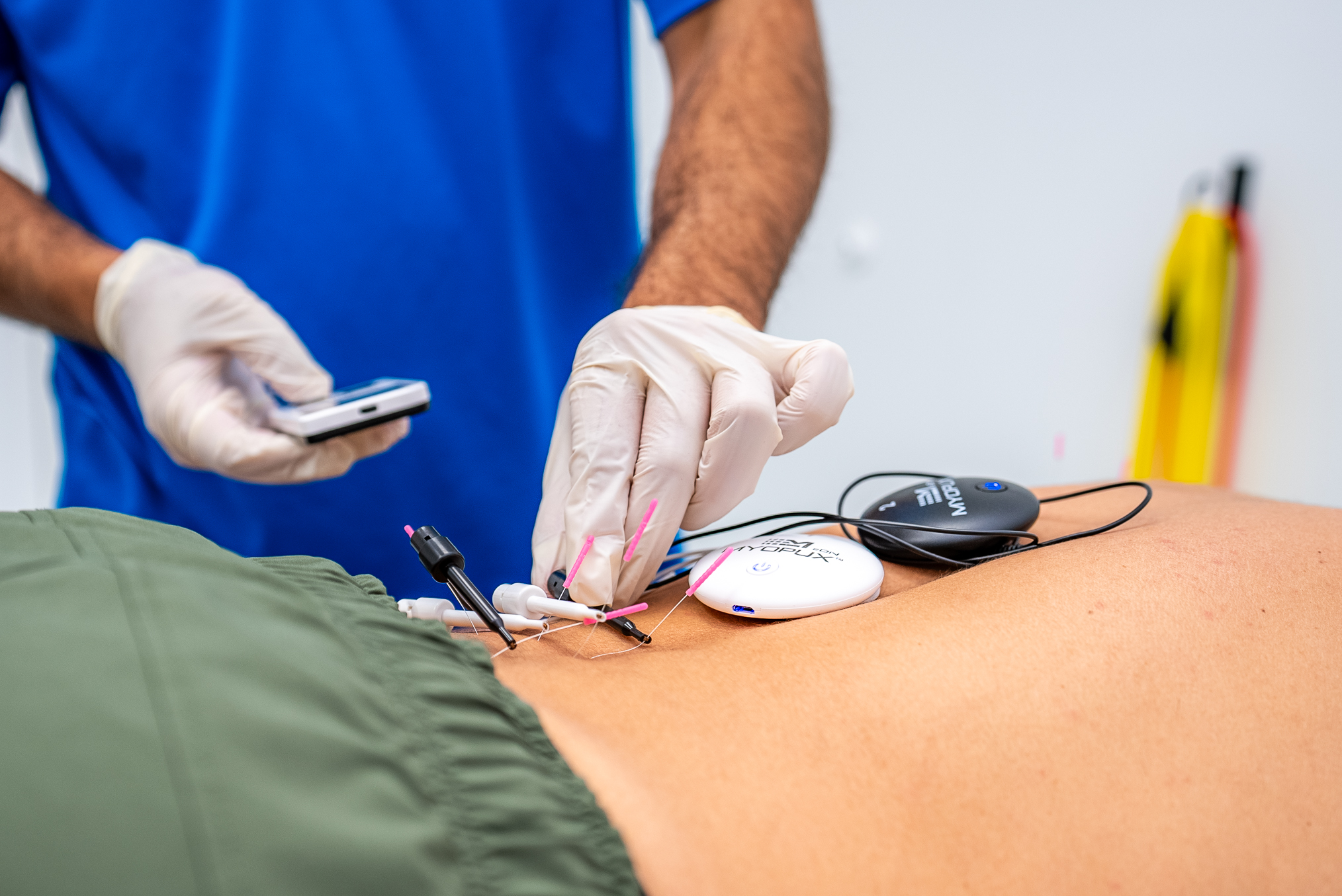 Dry Needling at Precision Physical Therapy in Sandy, UT